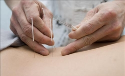 Le rôle bénéfique de l’acupuncture