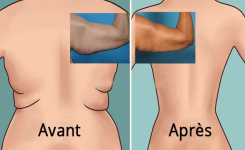 L'exercice brûle-graisse pour muscler le dos et la région des aisselles 