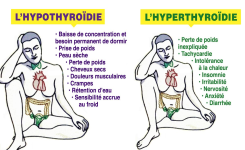 Comment distinguer l’hypothyroïdie du l’hyperthyroïdie et comment les prevenir à temps?