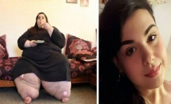 Elle pesait 300 kilos, maintenant, regardez sa transformation incroyable après avoir perdu 121 kilos !