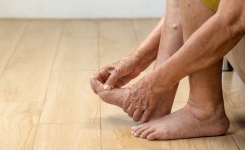 Ce Que L’état de Vos Pieds Peut Dire Sur Votre Santé Générale