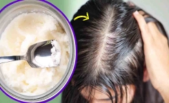 Comment utiliser l'huile de noix de coco pour arrêter la chute de cheveux et accélérer leur croissance ?