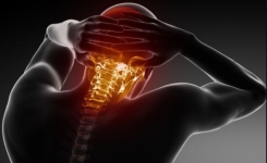 La cervicobrachialgie cette douleur qui part du cou jusqu’au bras