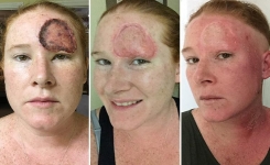 Cette mère garde des photos choquantes de sa guérison du cancer, après l’avoir confondu avec de simples troubles hormonaux