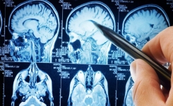 La neuroscience révèle enfin ce que le jeûne fait à votre cerveau