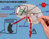 Comment le cerveau réagit face à un traumatisme