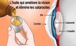 L’huile de ricin améliore la vision et élimine les cataractes (comment l’utiliser)