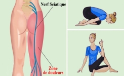 Les 3 meilleurs exercices pour soulager la douleur sciatique en quelques minutes