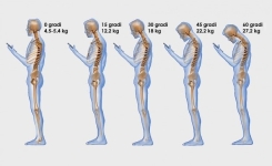 Regarder trop le téléphone portable impose un stress important sur la colonne vertébrale
