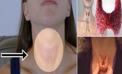 En utilisant 1 seul ingrédient naturel, rétablissez chaque anomalie éventuelle au niveau de votre thyroïde 