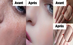 Masque de beauté pour estomper les taches brunes de nuit pour se réveiller aussi jolie qu’une princesse