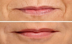 Voici comment lisser les lignes autour de vos lèvres en seulement 3 minutes