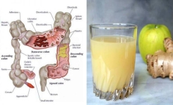 Le jus de nettoyage du côlon à 3 ingrédients : Comment les pommes, le gingembre et le citron peuvent expulser des kilos de toxines de votre corps