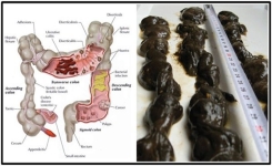 Voici comment une combinaison à base de 3 jus arrive à purifier votre côlon … Évacuez jusqu’à 5 kg de Toxines par JOUR !!!