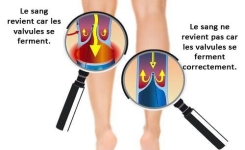 Comment relancer la circulation sanguine dans vos jambes à l’aide du citron