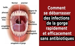 6 remèdes naturels efficaces pour traiter une infection de la gorge