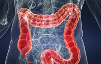 Syndrome de l’intestin irritable : quels aliments privilégier (ou éviter) ?