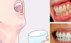 Mode d’Emploi : Une astuce géniale pour vous débarrasser des dents jaunes !