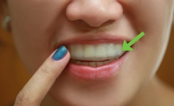 Solution efficace pour blanchir les dents 