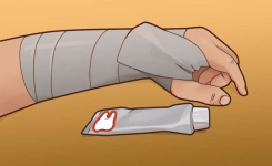 Saviez-vous que le dentifrice peut guérir une ecchymose ?