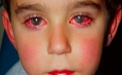Cet enfant a perdu 75% de sa vue à cause d’un jouet que vous êtes susceptibles d’avoir à la maison