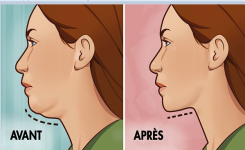 Comment réduire le double menton naturellement ?