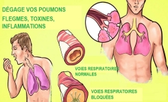Voici comment débarrasser vos poumons et votre gorge des flegmes persistants