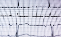 8 signes que votre cœur ne fonctionne pas correctement