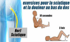 6 des meilleurs exercices pour soulager la sciatique et le bas du dos !