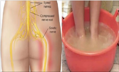 Vous souffrez de douleurs du nerf sciatique? Découvrez une Méthode Naturelle et Efficace pour un Soulagement Rapide !