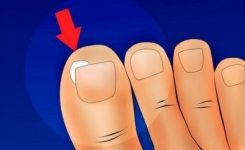 Comment éviter que nos ongles s’incarnent avec cette technique