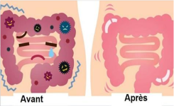 Nettoyage gastro-intestinale : un guide complet pour débusquer de vieilles incrustations fécales