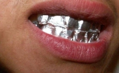 Voici ce qui se passera si vous gardez de papier d'aluminium sur vos dents