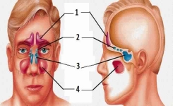 Mettre un terme à l’infection du sinus avec ces 4 remèdes de Grand-Mère