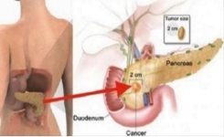 Evitez absolument de manger cet aliment, il cause le cancer du pancréas !!