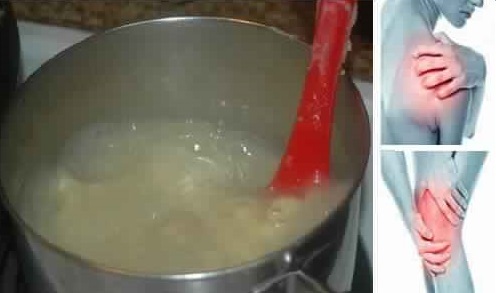 Soulagez Vos Douleurs Articulaires avec ce Remède Naturel Fait Maison