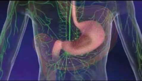 Cancer de l’estomac – Symptômes, causes et traitement [vidéo]