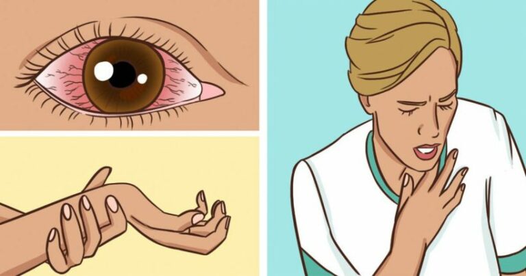 Les signes qui révèlent que vous avez été exposé à des moisissures toxiques et voici ce qu’il faut faire