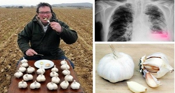 Pourquoi Vous Devriez Manger de l’Ail Tous les Jours (Même si Vous Détestez Son Odeur