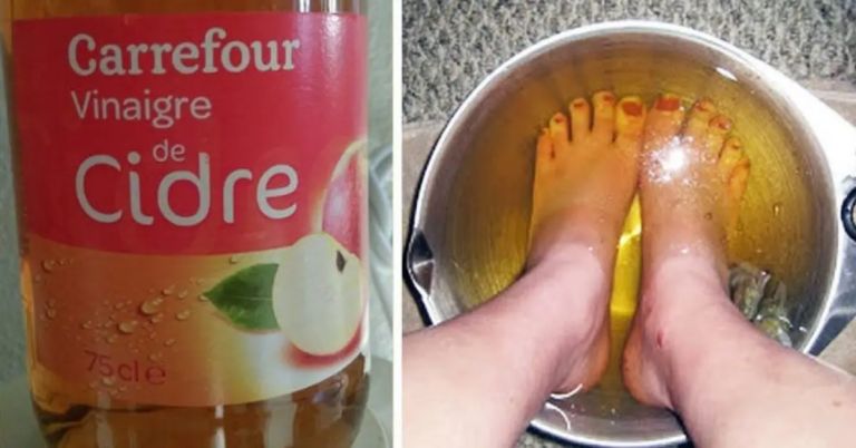 # Trempez vos pieds dans le vinaigre une fois par semaine : 9 bienfaits surprenants