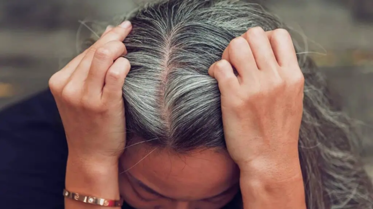 Quelle est la cause des cheveux blancs chez les jeunes ?
