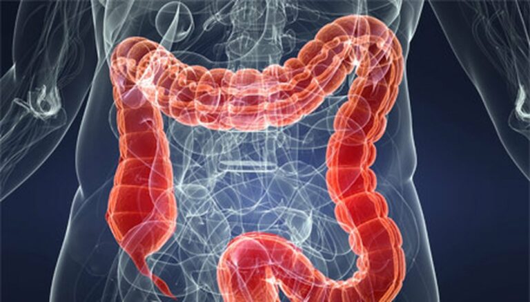 Syndrome de l’intestin irritable : quels aliments privilégier (ou éviter) ?
