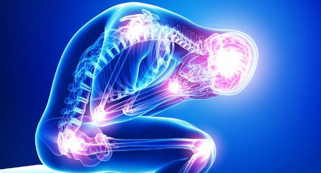 Qu’est-ce que la fibromyalgie ? Guide complet pour comprendre cette maladie